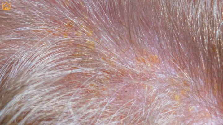 Seborrhea in dogs